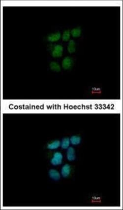 Invitrogen NR0B2 Polyclonal Antibody 100 &mu;L; Unconjugated:Antibodies,
