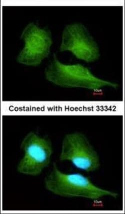 Invitrogen Cullin 7 Polyclonal Antibody 100 &mu;L; Unconjugated:Antibodies,
