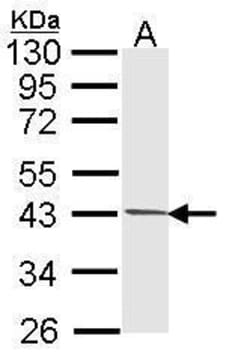 Invitrogen PIM2 Polyclonal Antibody 100 &mu;L; Unconjugated:Antibodies,