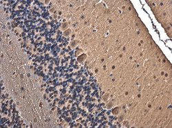 Invitrogen TRIM32 Polyclonal Antibody 100 &mu;L; Unconjugated:Antibodies,