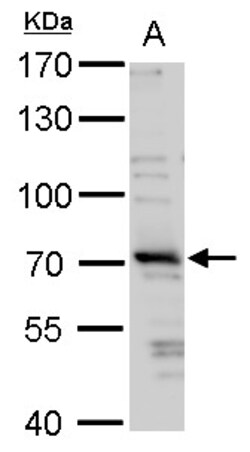 Invitrogen TRIM32 Polyclonal Antibody 100 &mu;L; Unconjugated:Antibodies,