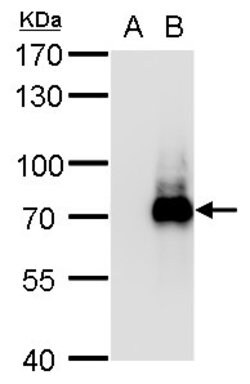 Invitrogen TRIM32 Polyclonal Antibody 100 &mu;L; Unconjugated:Antibodies,