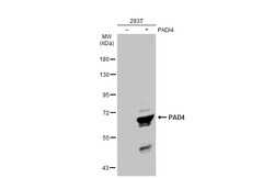 Invitrogen PADI4 Polyclonal Antibody 100 &mu;L; Unconjugated:Anticuerpos