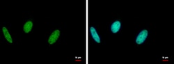 Invitrogen RAD18 Polyclonal Antibody 100 &mu;L; Unconjugated:Antibodies,