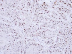 Invitrogen RAD18 Polyclonal Antibody 100 &mu;L; Unconjugated:Antibodies,