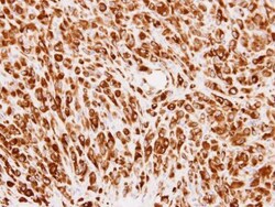 Invitrogen PMM2 Polyclonal Antibody 100 &mu;L; Unconjugated:Antibodies,