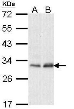 Invitrogen PMM2 Polyclonal Antibody 100 &mu;L; Unconjugated:Antibodies,