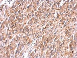 Invitrogen NDUFS8 Polyclonal Antibody 100 &mu;L; Unconjugated:Antibodies,