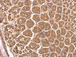 Invitrogen NDUFS8 Polyclonal Antibody 100 &mu;L; Unconjugated:Antibodies,
