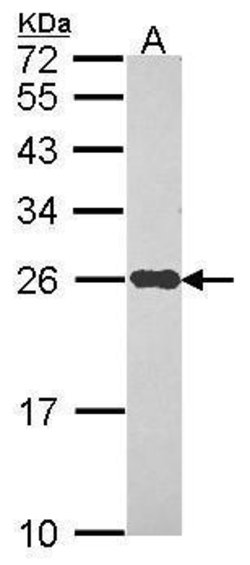 Invitrogen NDUFS8 Polyclonal Antibody 100 &mu;L; Unconjugated:Antibodies,