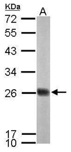Invitrogen NDUFS8 Polyclonal Antibody 100 &mu;L; Unconjugated:Antibodies,