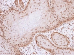 Invitrogen Livin Polyclonal Antibody 100 &mu;L; Unconjugated:Antibodies,
