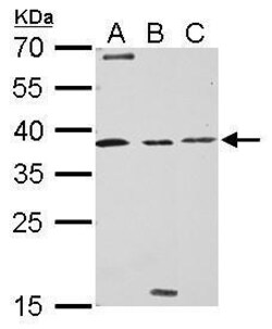Invitrogen Livin Polyclonal Antibody 100 &mu;L; Unconjugated:Antibodies,