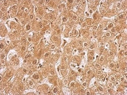 Invitrogen AMPK gamma-2 Polyclonal Antibody 100 &mu;L; Unconjugated:Antibodies,
