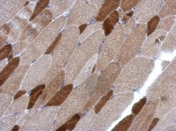 Invitrogen RGS4 Polyclonal Antibody 100 &mu;L; Unconjugated:Antibodies,