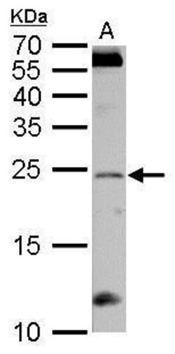 Invitrogen RGS4 Polyclonal Antibody 100 &mu;L; Unconjugated:Antibodies,