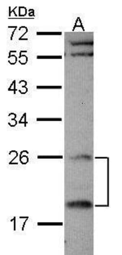 Invitrogen RGS4 Polyclonal Antibody 100 &mu;L; Unconjugated:Antibodies,
