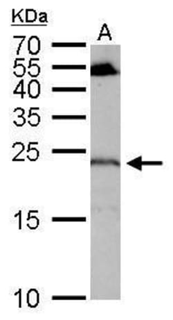 Invitrogen RGS4 Polyclonal Antibody 100 &mu;L; Unconjugated:Antibodies,