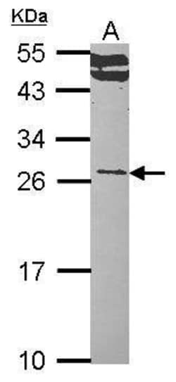 Invitrogen RALA Polyclonal Antibody 100 &mu;L; Unconjugated:Antibodies,