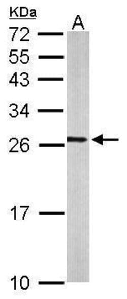 Invitrogen RALA Polyclonal Antibody 100 &mu;L; Unconjugated:Antibodies,