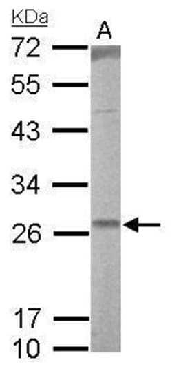 Invitrogen RALA Polyclonal Antibody 100 &mu;L; Unconjugated:Antibodies,
