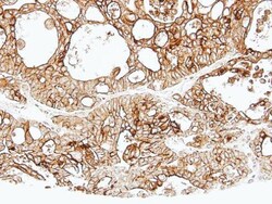 Invitrogen ALPPL2 Polyclonal Antibody 100 &mu;L; Unconjugated:Antibodies,