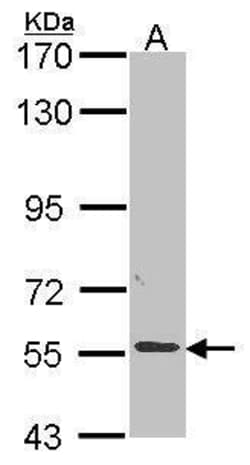 Invitrogen ALPPL2 Polyclonal Antibody 100 &mu;L; Unconjugated:Antibodies,