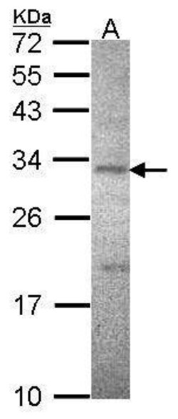 Invitrogen CD298 Polyclonal Antibody 100 &mu;L | Buy Online | Invitrogen&trade; | Fisher Scientific