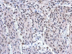 Invitrogen hnRNP F Polyclonal Antibody 100 &mu;L; Unconjugated:Antibodies,