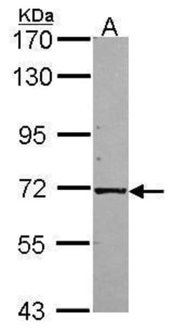 Invitrogen KLC1 Polyclonal Antibody 100 &mu;L; Unconjugated:Antibodies,