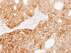 Invitrogen LAD1 Polyclonal Antibody 100 &mu;L; Unconjugated:Antibodies,