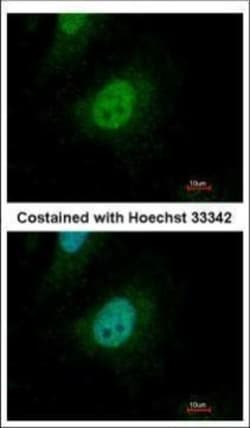 Invitrogen SMAD9 Polyclonal Antibody 100 μL; Unconjugated:Antibodies,