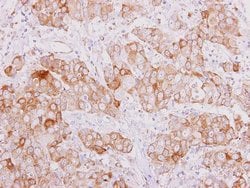 Invitrogen SMAD9 Polyclonal Antibody 100 μL; Unconjugated:Antibodies,