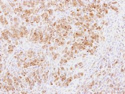 Invitrogen PABPC3 Polyclonal Antibody 100 &mu;L; Unconjugated:Antibodies,