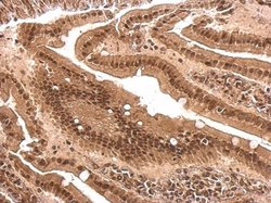 Invitrogen PCBP2 Polyclonal Antibody 100 &mu;L; Unconjugated:Antibodies,