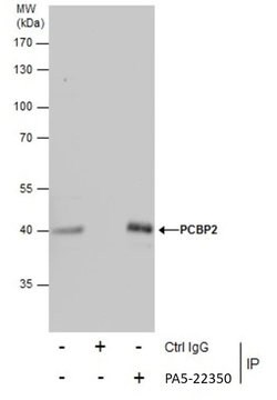 Invitrogen PCBP2 Polyclonal Antibody 100 &mu;L; Unconjugated:Antibodies,