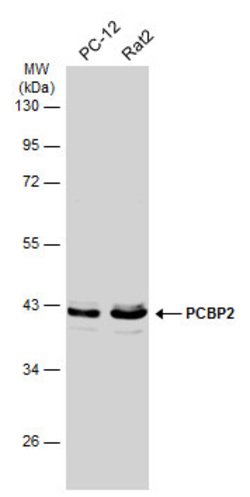 Invitrogen PCBP2 Polyclonal Antibody 100 &mu;L; Unconjugated:Antibodies,