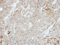 Invitrogen PCDH1 Polyclonal Antibody 100 &mu;L; Unconjugated:Antibodies,