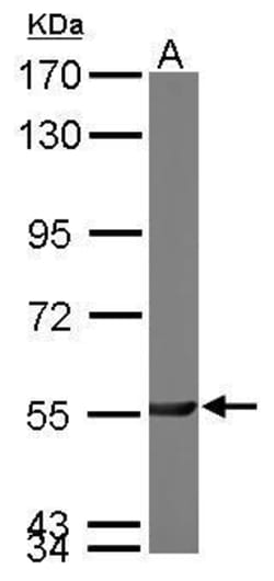 Invitrogen PGM3 Polyclonal Antibody 100 &mu;L; Unconjugated:Antibodies,