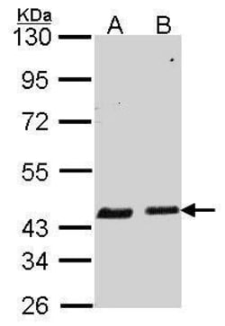 Invitrogen SERPINB6 Polyclonal Antibody 100 μL; Unconjugated:Antibodies,