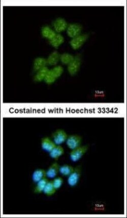 Invitrogen SLA Polyclonal Antibody 100 &mu;L; Unconjugated:Antibodies,