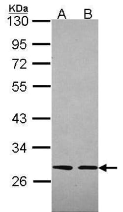 Invitrogen SLA Polyclonal Antibody 100 &mu;L; Unconjugated:Antibodies,