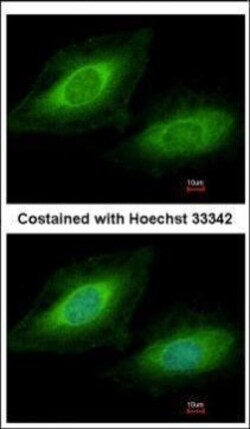 Invitrogen&trade;&nbsp;TSSC1 Polyclonal Antibody