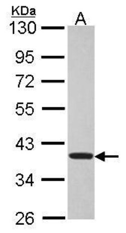 TSSC1 Polyclonal Antibody, Invitrogen™