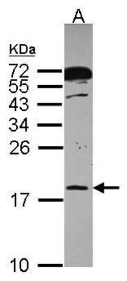 Invitrogen POLR2H Polyclonal Antibody 100 &mu;L | Buy Online | Invitrogen&trade; | Fisher Scientific