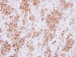 Invitrogen HLA-DMA Polyclonal Antibody 100 &mu;L; Unconjugated:Antibodies,