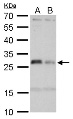 Invitrogen HLA-DMA Polyclonal Antibody 100 &mu;L; Unconjugated:Antibodies,