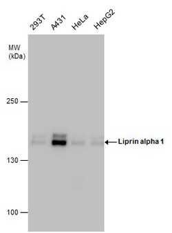 Invitrogen PPFIA1 Polyclonal Antibody 100 &mu;L; Unconjugated:Antibodies,