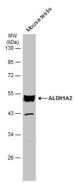 Invitrogen ALDH1A2 Polyclonal Antibody 100 &mu;L | Buy Online | Invitrogen&trade; | Fisher Scientific