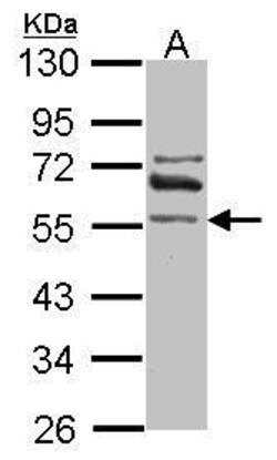 Invitrogen ALDH1A2 Polyclonal Antibody 100 &mu;L | Buy Online | Invitrogen&trade; | Fisher Scientific